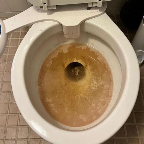 Toilet bowl before cleaning